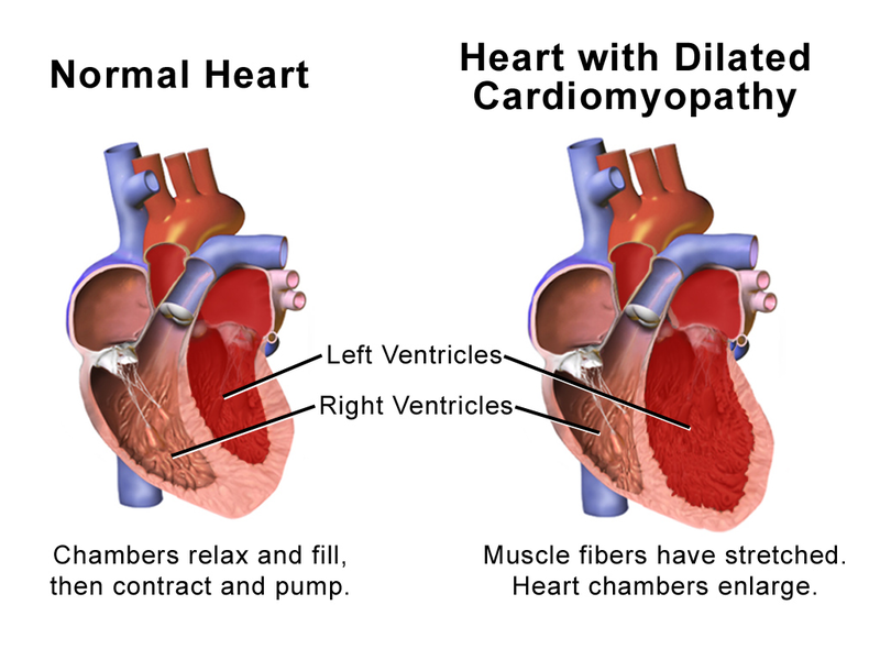 enlarged heart in dogs cardiomyopathy in dogs dilated cardiomyopathy in dogs dog enlarged heart life expectancy