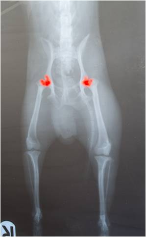 Hip dysplasia