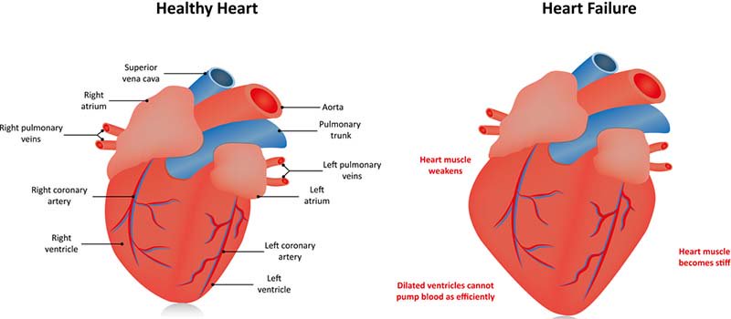 Congestive-Heart-Failure-in-Dogs