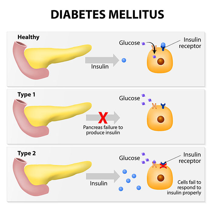 diabetes mellitus in dogs types of diabetes thumbnail