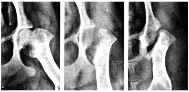 FHO1 - Radiographs xray of an eight-month-old 5 kg Jack Russell Terrier with Legg-Calve-Perthes disease and FHO surgery Femoral Head and Neck Osectomy before and post surgery