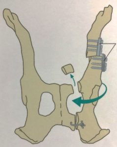 TPO 3 Diagram showing procedure of Triple Pelvis Osteotomy done in dog