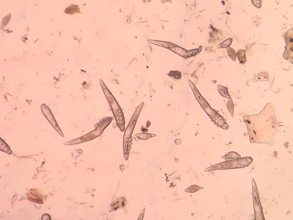 Demodex mange from a microscope view.